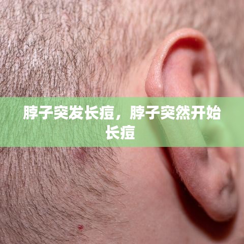 脖子突发长痘，脖子突然开始长痘 