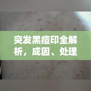 突发黑痘印全解析，成因、处理及预防方法