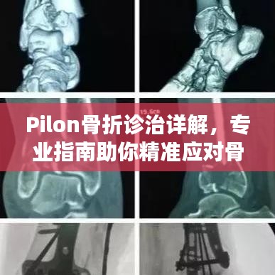 张弓挟矢 第2页